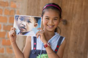 Vietnam Airlines triển khai chiến dịch “Quyên góp Dặm bay” hỗ trợ phẫu thuật cho trẻ em Việt Nam